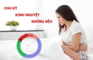 Rối loại chu kỳ kinh nguyet