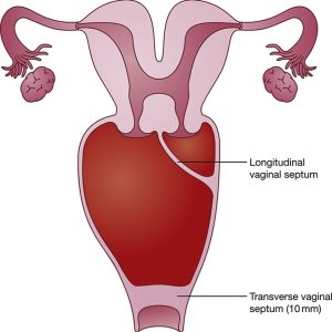 các bệnh thường gặp ở âm đạo