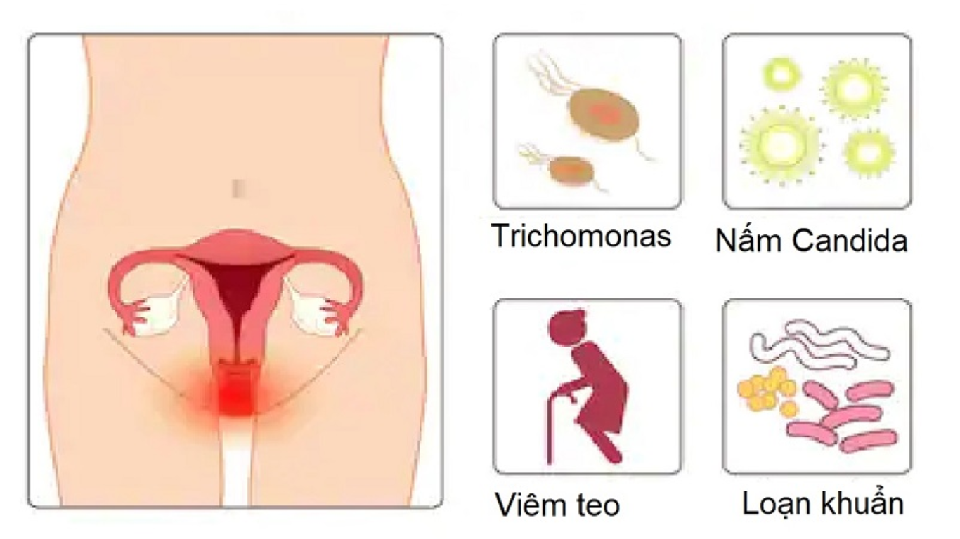 Sử dụng nước xịt thơm vùng kín nữ hiệu quả